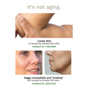 Adipeau Strong Body Gel, alternate view