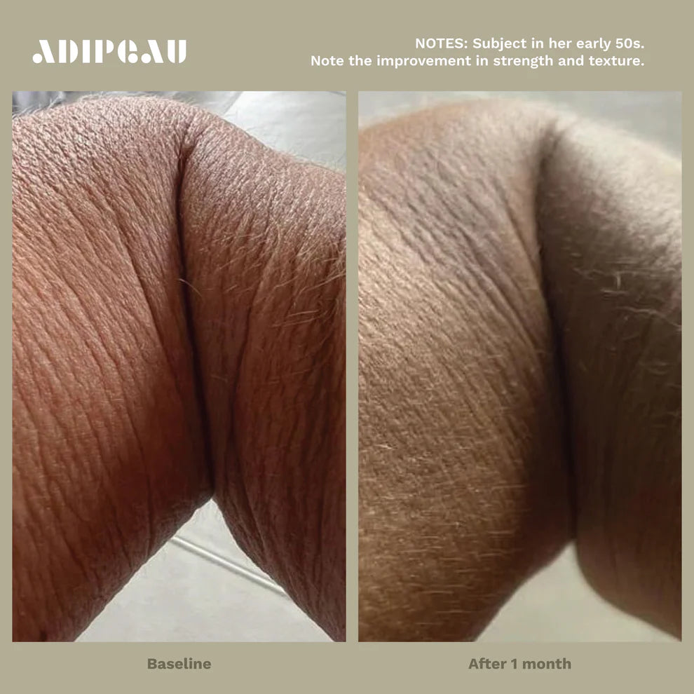 Adipeau Strong Body Gel, alternate view