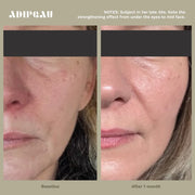 Adipeau Strong Body Gel, alternate view