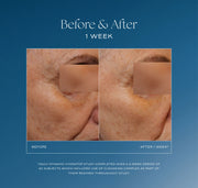 iS Clinical Daily Dynamic Hydrator, alternate view