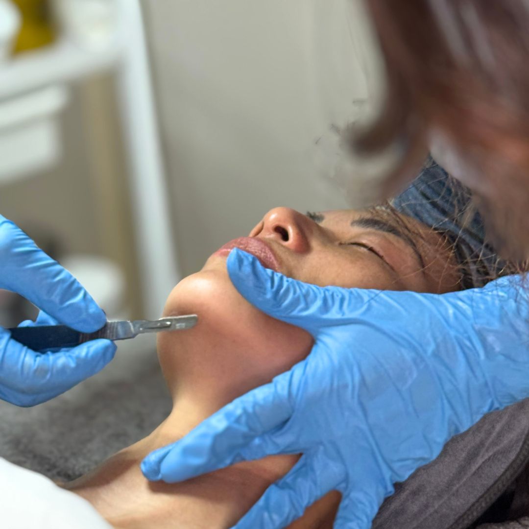 Dermaplaning