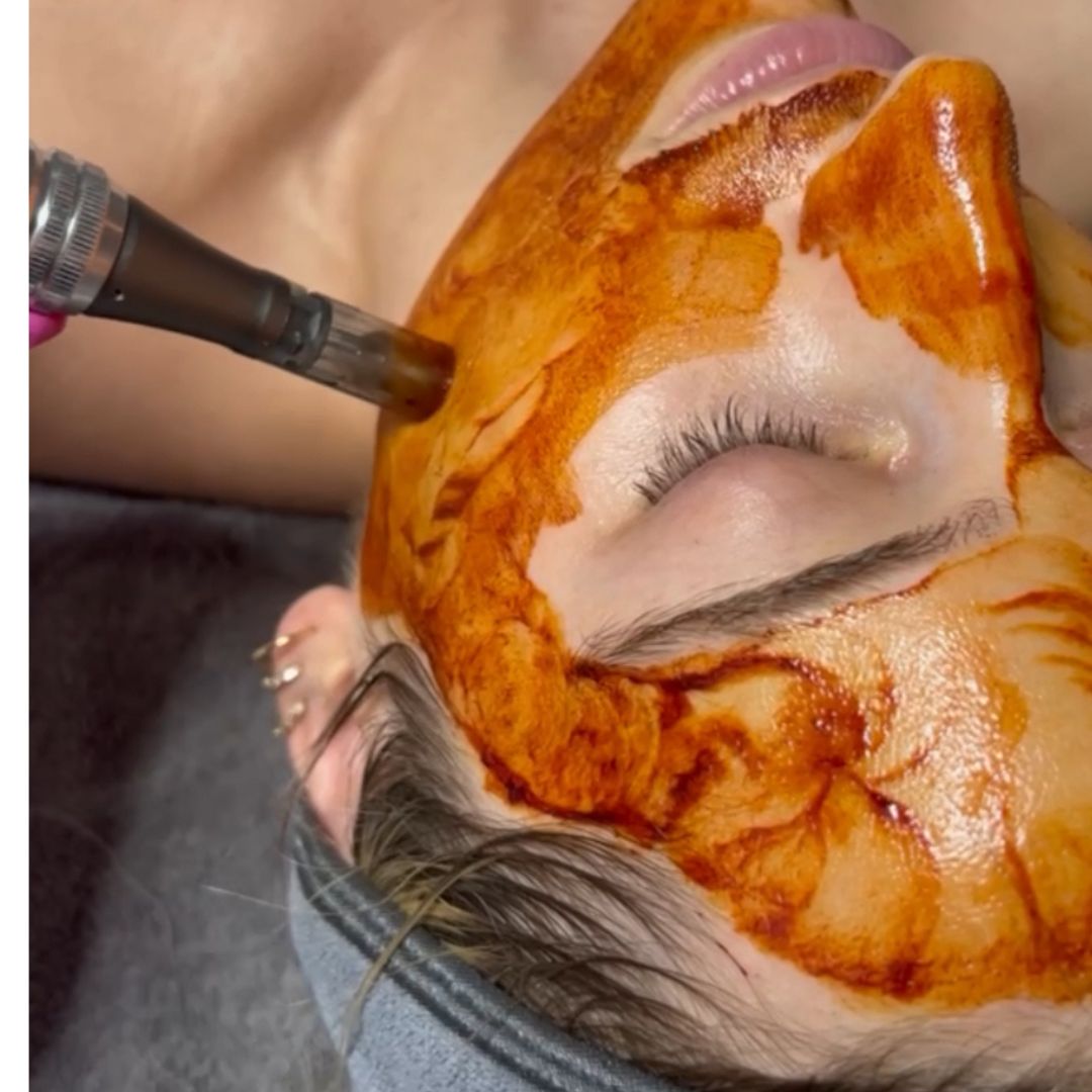Nano Infusion Facial