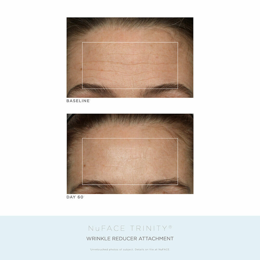 Nu Face Trinity Pro Facial Toning Device