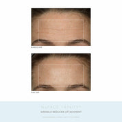 Nu Face Trinity Pro Facial Toning Device